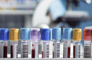 RESTORE trial studies lifespan of lab-grown blood cells